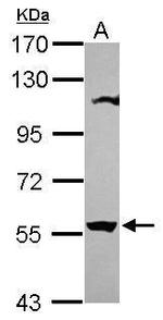 OASL Antibody in Western Blot (WB)