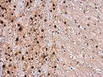 Phospho-ROCK2 (Ser1366) Antibody in Immunohistochemistry (Paraffin) (IHC (P))