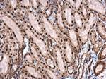 Phospho-ROCK2 (Ser1366) Antibody in Immunohistochemistry (Paraffin) (IHC (P))