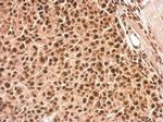 Phospho-ROCK2 (Ser1366) Antibody in Immunohistochemistry (Paraffin) (IHC (P))