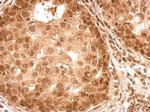 Phospho-ROCK2 (Ser1366) Antibody in Immunohistochemistry (Paraffin) (IHC (P))