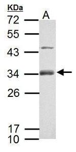 RSPO1 Antibody in Western Blot (WB)