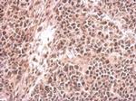 EHMT2 Antibody in Immunohistochemistry (Paraffin) (IHC (P))