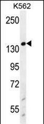 WRN Antibody in Western Blot (WB)