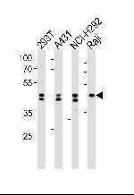 hnRNP D Antibody in Western Blot (WB)