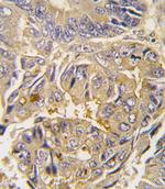 ATG16L1 Antibody in Immunohistochemistry (Paraffin) (IHC (P))