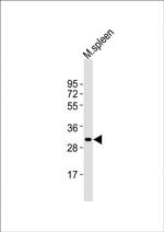 MSX1 Antibody in Western Blot (WB)