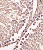 Cyclin B1 Antibody in Immunohistochemistry (Paraffin) (IHC (P))