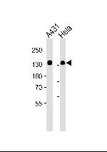GTF2I Antibody in Western Blot (WB)
