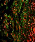 CD11c Antibody in Immunohistochemistry (Paraffin) (IHC (P))