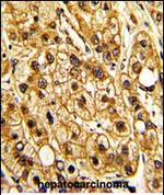 CD11c Antibody in Immunohistochemistry (Paraffin) (IHC (P))