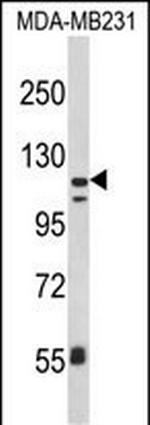 CD11c Antibody in Western Blot (WB)