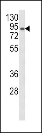 AOC3 Antibody in Western Blot (WB)