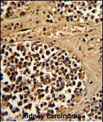 ESRRA Antibody in Immunohistochemistry (Paraffin) (IHC (P))