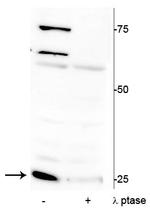 Phospho-Cardiac Troponin I (Ser150) Antibody in Western Blot (WB)