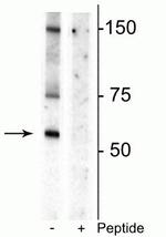 Phospho-Dopamine Transporter (Thr53) Antibody in Western Blot (WB)