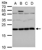 LZIC Antibody in Western Blot (WB)