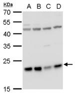 LZIC Antibody in Western Blot (WB)