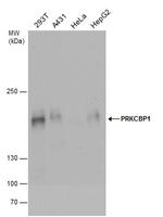 ZMYND8 Antibody in Western Blot (WB)