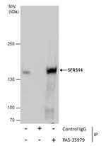 SUGP2 Antibody in Immunoprecipitation (IP)