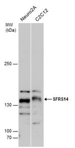 SUGP2 Antibody in Western Blot (WB)