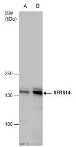 SUGP2 Antibody in Western Blot (WB)