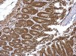 VEPH1 Antibody in Immunohistochemistry (Paraffin) (IHC (P))