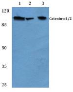 alpha Catenin Antibody in Western Blot (WB)