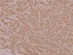 HYD Antibody in Immunohistochemistry (Paraffin) (IHC (P))