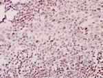 ZNF75D Antibody in Immunohistochemistry (Paraffin) (IHC (P))