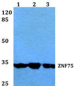 ZNF75D Antibody in Western Blot (WB)