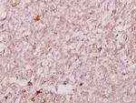 FOXJ1 Antibody in Immunohistochemistry (Paraffin) (IHC (P))