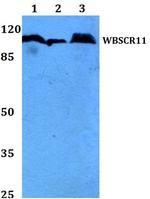 GTF2IRD1 Antibody in Western Blot (WB)