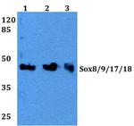 SOX8/SOX9/SOX17/SOX18 Antibody in Western Blot (WB)