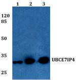 RNF144A Antibody in Western Blot (WB)