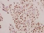 CPI-17 Antibody in Immunohistochemistry (Paraffin) (IHC (P))