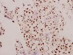 CPI-17 Antibody in Immunohistochemistry (Paraffin) (IHC (P))