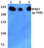 Phospho-WNK1 (Thr60) Antibody in Western Blot (WB)