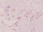 Phospho-S6 (Ser240) Antibody in Immunohistochemistry (Paraffin) (IHC (P))