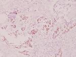 Phospho-S6 (Ser240) Antibody in Immunohistochemistry (Paraffin) (IHC (P))