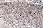 Phospho-VASP (Ser238) Antibody in Immunohistochemistry (Paraffin) (IHC (P))