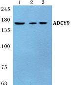 Adenylate Cyclase 9 Antibody in Western Blot (WB)