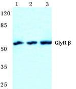 GLRB Antibody in Western Blot (WB)