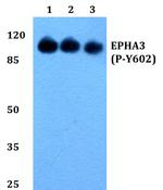 Phospho-EphA3 (Tyr602) Antibody in Western Blot (WB)