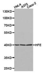 HFE Antibody in Western Blot (WB)