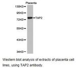 TAP2 Antibody in Western Blot (WB)