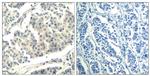 Phospho-ABL1/ABL2 (Tyr393, Tyr439) Antibody in Immunohistochemistry (Paraffin) (IHC (P))