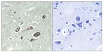 Phospho-Calmodulin (Thr79, Ser81) Antibody in Immunohistochemistry (Paraffin) (IHC (P))