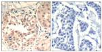 Phospho-CDK6 (Tyr13) Antibody in Immunohistochemistry (Paraffin) (IHC (P))