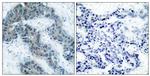 Phospho-JAK2 (Tyr1007) Antibody in Immunohistochemistry (Paraffin) (IHC (P))